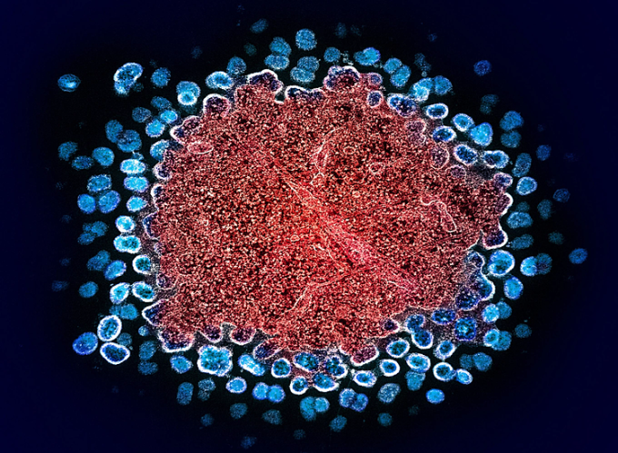 Minh họa virus HIV. Ảnh: NIH