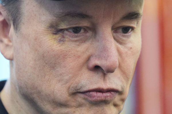 Elon Musk tiết lộ lý do mắt bị bầm: Chuyện gì xảy ra?