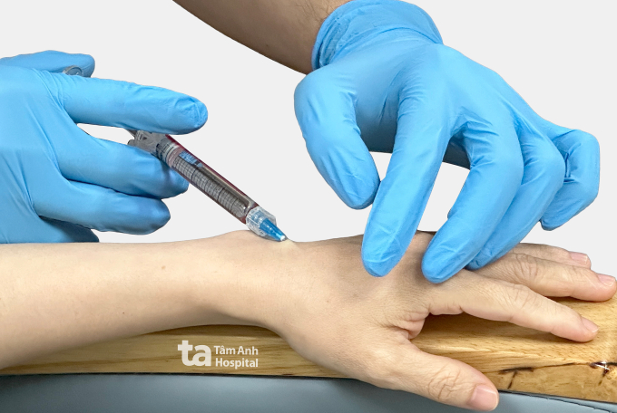 Bác sĩ tiêm filler làm đầy bàn tay cho người bệnh. Ảnh minh họa: Bệnh viện Đa khoa Tâm Anh