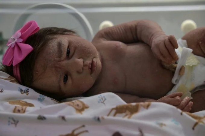 Một búp bê siêu thực trong cửa hàng Bệnh viện Phụ sản Trẻ em Alana ở thành phố Campinas, bang Sao Paulo, ngày 16/5. Ảnh: AFP
