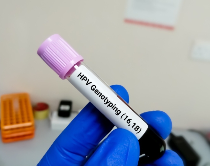 Ống xét nghiệm HPV. Ảnh minh họa: Vecteezy