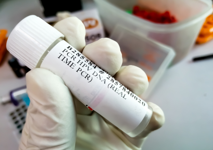 Minh họa ống xét nghiệm HPV. Ảnh: Vecteezy