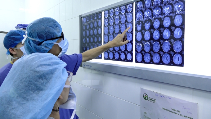 Các chẩn đoán hình ảnh hỗ trợ rất lớn cho bác sĩ trong quá trình điều trị. Ảnh: Thế Quỳnh