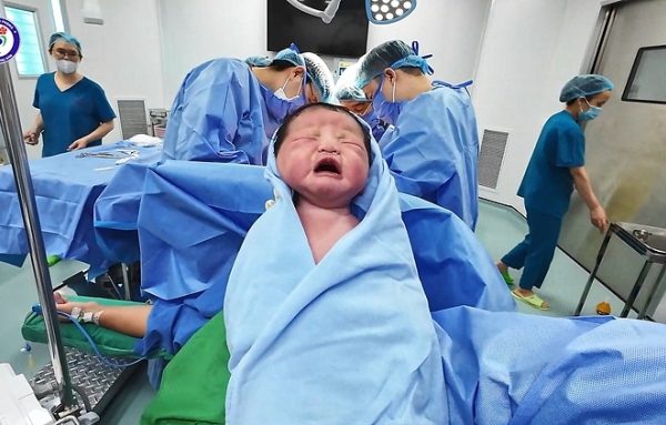 Em bé sơ sinh nặng 5,2kg chào đời khỏe mạnh