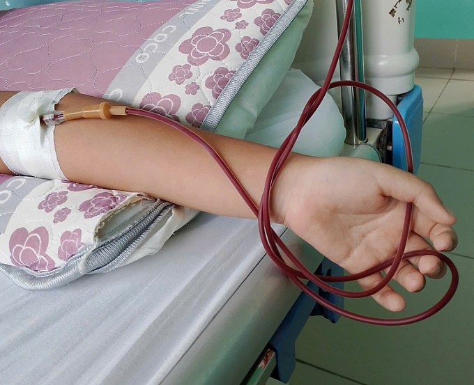 Hàng tháng bệnh nhi lại phải vào viện truyền máu, tốn kém chi phí, mệt mỏi. Ảnh: Gia đình cung cấp