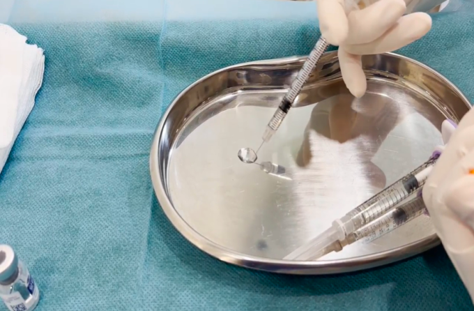 Bác sĩ thử chất lượng filler. Ảnh: Bác sĩ cung cấp