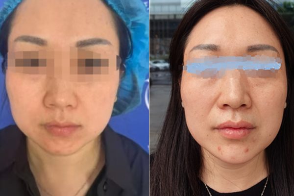 Vay tiền làm đẹp, vợ hối hận giấu chồng: Bài học đắt giá