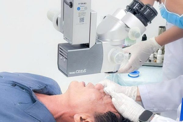 Bỏng mắt do xăng: Cảnh báo và sơ cứu