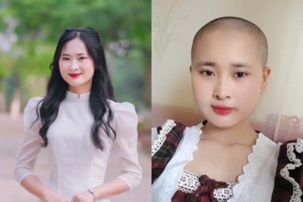 Ung thư ở người trẻ: Câu chuyện và nỗi đau