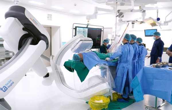 Xơ vữa mạch máu do thuốc lá: Nguy cơ sau nhiều năm