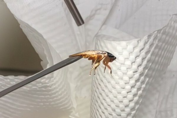 Gắp sống con gián khỏi tai: Cứu nguy kịp thời