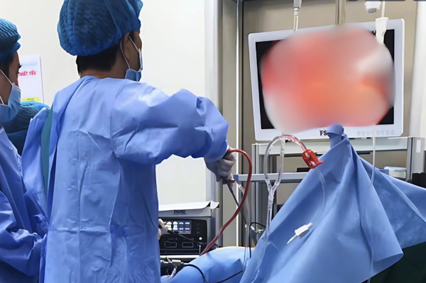 Thủng túi mật gây đau bụng, sốt cao: Nguyên nhân và dấu hiệu