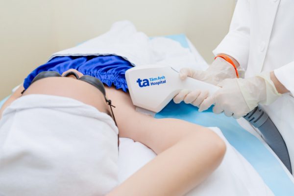Triệt lông nách vĩnh viễn bằng công nghệ IPL: Hiệu quả thế nào?