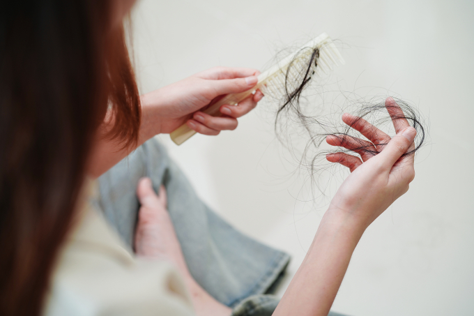 Nếu gặp tình trạng rụng tóc kéo dài, bạn nên tìm đến bác sĩ chuyên khoa da liễu để được chẩn đoán chính xác nguyên nhân. Ảnh minh họa: Vecteezy