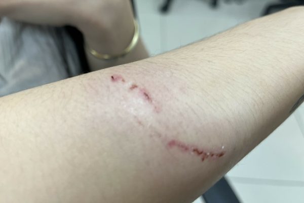 Hủy chuyến du lịch vì bị chó mèo cắn: Cảnh báo và phòng ngừa