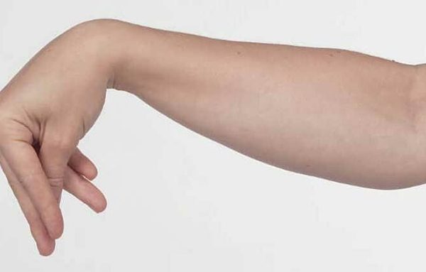 Cô gái 19 tuổi thoát khỏi cơn co rút, khó thở kéo dài: Lời giải