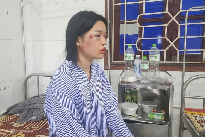 Chị Anh Thư kể lại giây phút gặp nạn trên xe khách. Ảnh: Đức Hùng