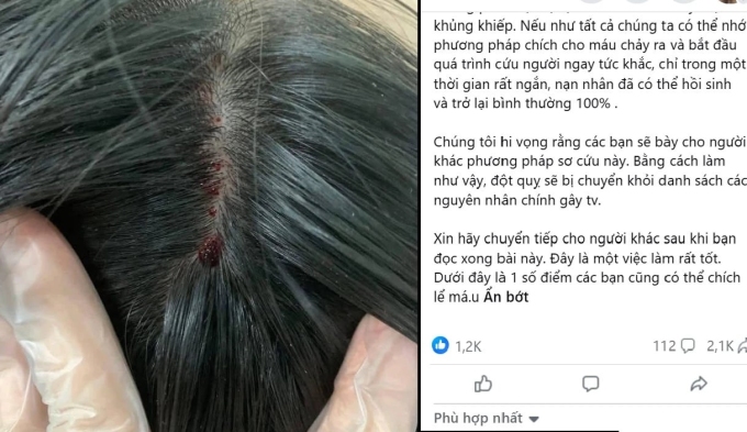 Nhiều thông tin về chích máu chữa đột quỵ được đăng công khai. Ảnh: Ảnh chụp màn hình