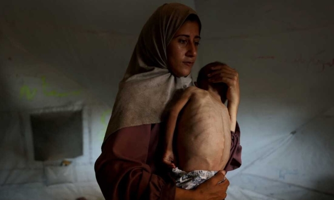 Một người mẹ ở Gaza bế con trai 18 tháng tuổi đang ốm yếu và có dấu hiệu suy dinh dưỡng tại trại tị nạn Al-Shati, phía tây Gaza City, hôm 24/7. Ảnh: AFP