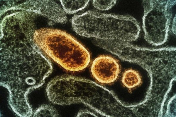 Thử nghiệm vaccine phòng virus Nipah trên người: Tin mới nhất