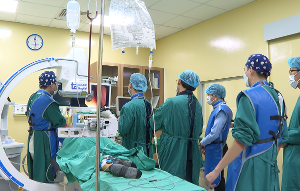 Sỏi ống mật: Ca bệnh nội soi ERCP thành công
