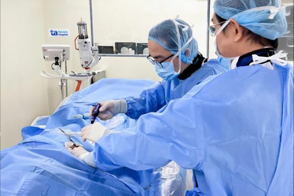 Phình động mạch chủ ngực và u nhầy ruột thừa: Tổng quan