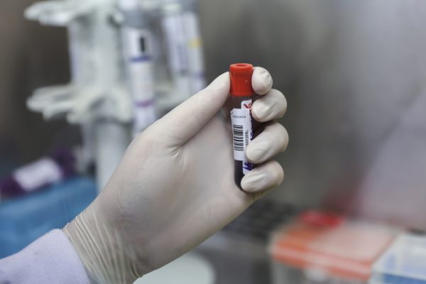 Loại enzyme ‘bí ẩn’ trong máu khiến trẻ bị chẩn đoán nhầm bệnh