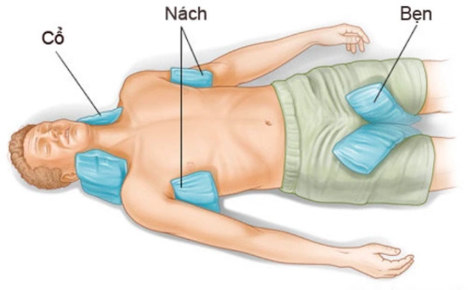 Để hạ nhiệt, nên áp khăn ẩm đắp vào nách, bẹn, cổ cho bệnh nhân say nắng. Ảnh: Examiner