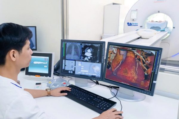 Chụp CT: Phát hiện sớm nguy cơ nhồi máu cơ tim?