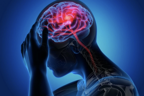 Đột quỵ tim và đột quỵ não: Phân biệt thế nào?