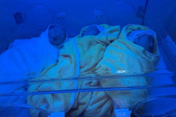 Tam thai tự nhiên: Sản phụ sinh 3 bé trai khỏe mạnh