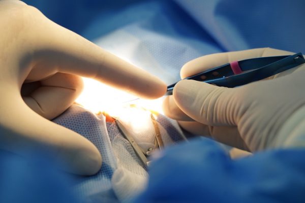 Lừa đảo thẻ hiến tạng: Mạo danh Bệnh viện Chợ Rẫy chiếm đoạt tiền
