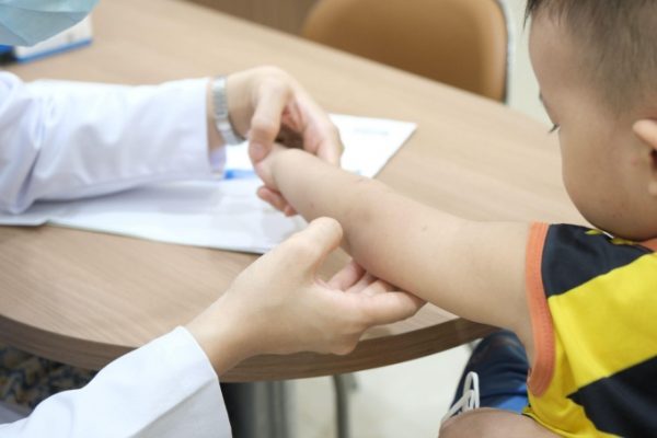 4 Bệnh nguy hiểm do muỗi đốt trẻ em cần biết