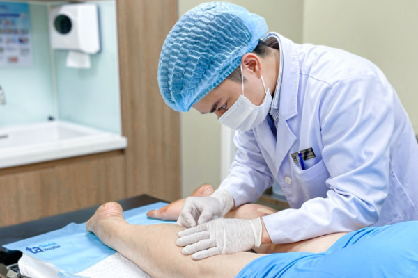 Điều trị suy giãn tĩnh mạch bằng chích xơ: Hiệu quả và an toàn