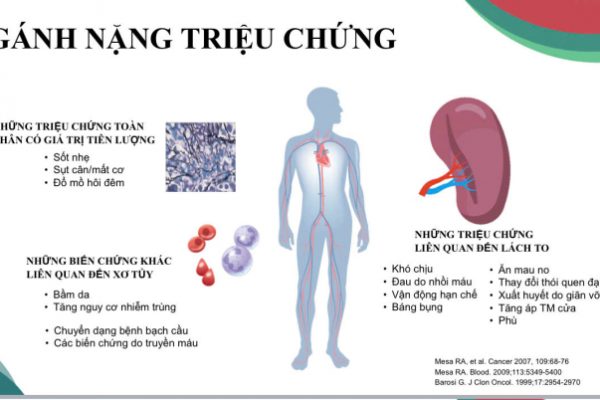 Xơ tủy: Bệnh lý huyết học ác tính nguy hiểm cần biết