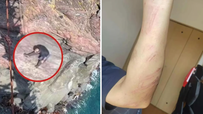 Ông Yang bị trầy xước nhẹ ở tay khi leo vách đá xuống bãi biển cứu người. Ảnh: SCMP