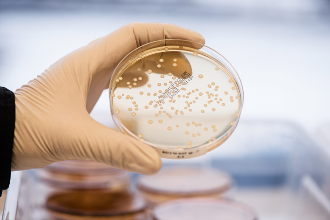 Đĩa petri có chứa các khuẩn lạc vi khuẩn đã được nuôi cấy. Ảnh: Biogaiagroup