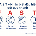 Quy tắc F.A.S.T: Nhận biết sớm dấu hiệu đột quỵ