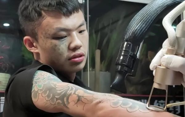 Hành trình làm lại cuộc đời của cậu bé xăm kín mặt