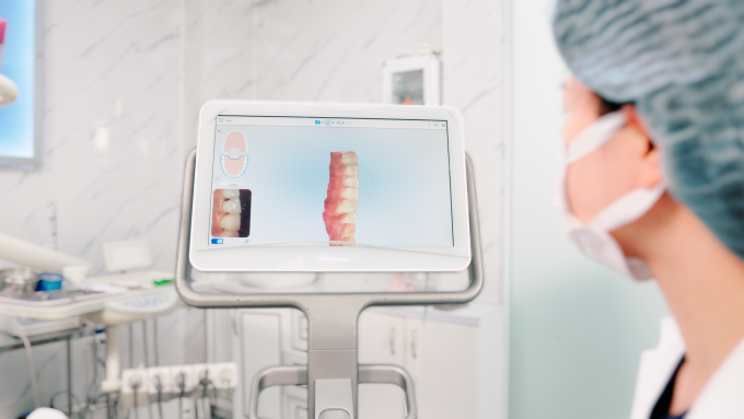 Dữ liệu quét iTero 3D trong niềng răng invisalign chính xác đến từng micromet. Ảnh: Nha khoa Quốc tế Việt Pháp