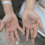 Nghiện bóng cười: Cuộc sống bên bờ vực của cặp vợ chồng