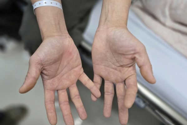 Nghiện bóng cười: Cuộc sống bên bờ vực của cặp vợ chồng