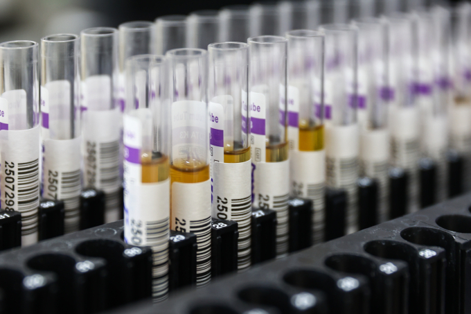 Khám sức khoẻ, xét nghiệm định kỳ có thể giúp phát hiện sớm và xử lý kịp thời các bất thường ở thận, ngăn diễn tiến thành suy thận mạn tính. Ảnh: Quỳnh Trần