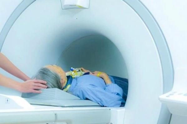 Tầm soát ung thư, đột quỵ bằng CT: Cảnh báo từ chuyên gia