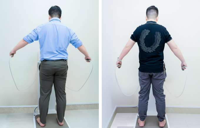 Anh Mạnh trước và sau khi giảm 12 kg. Ảnh: Bệnh viện Đa khoa Tâm Anh