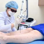 Điều trị sẹo mụn hiệu quả cho làn da thiếu nữ