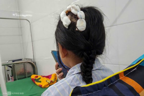 Bé lớp 5 bị bạo hành: Cuộc sống đau đớn dưới đòn roi