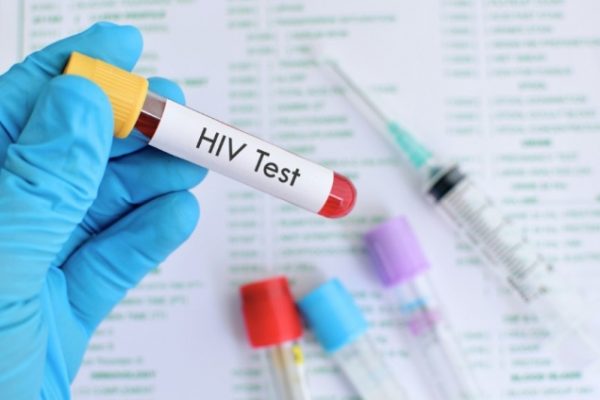 Chồng giấu HIV 10 năm, nói dối “bệnh gan”