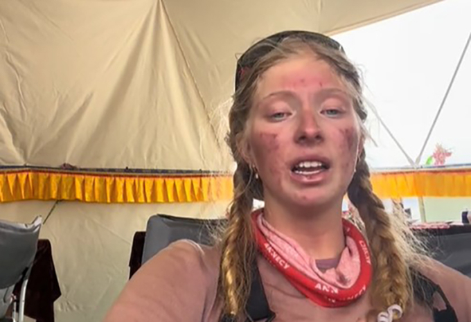 Nữ sinh 17 tuổi suýt mất mạng khi leo Vùng Chết trên đỉnh Everest