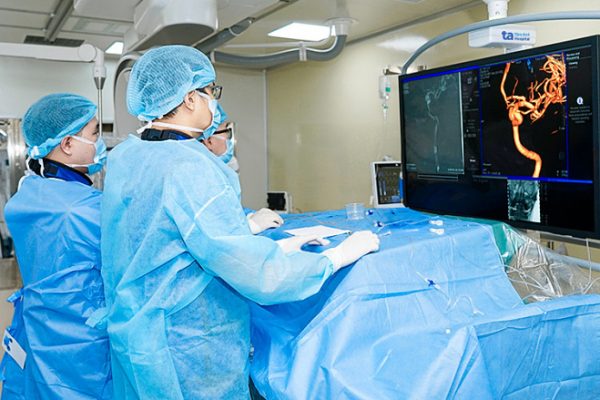 Đau đầu do túi phình mạch máu não: Nguyên nhân và điều trị